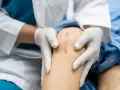 Lekarz w białej rękawiczce bada bliznę po operacji, która jest widoczna na kolanie pacjenta po zabiegu wszczepienia endoprotezy kolana.