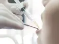 Dentysta podaje znieczulenie pacjentowi strzykawką.