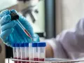 Laborant pobiera próbkę krwi do analizy. Dowiedz się, ile kosztuje test na HIV w laboratorium.