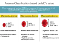 Anemia co to? Porównanie wielkości czerwonych krwinek: mikrocytarna (małe), normocytarna (normalne), makrocytarna (duże).