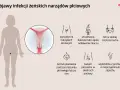 Ilustracja przedstawia sylwetkę kobiety z powiększeniem narządów płciowych i ikonami objawów infekcji.