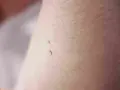 Dwa małe, brązowe znamiona na skórze, przypominające małe włókna.