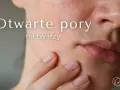 Zbliżenie na skórę twarzy z widocznymi, otwartymi porami. Dłoń delikatnie dotyka policzka, podkreślając tekst "Otwarte pory na twarzy".