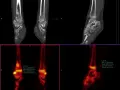 Co to jest SUV max i dlaczego jest kluczowy w diagnostyce medycznej