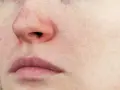 Gros plan sur un visage, avec un nez rouge froid, des lèvres fines et une peau marquée par les pores.
