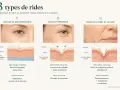 Infographie expliquant 3 types de rides : déshydratation, expression, installées. Solutions anti ride naturel pour chaque cause.