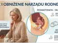 Lekarka omawia z pacjentką pessar kostkowy, który pomaga w leczeniu obniżenia narządów rodnych i poprawia komfort życia.