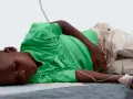Cholera Symptome: Warnzeichen erkennen und ernsthafte Folgen vermeiden