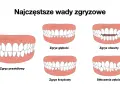Ilustracja pokazuje różne wady zgryzu: prawidłowy, głęboki, otwarty, krzyżowy i stłoczenia zębów.