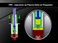 Illustration d'une seringue pour la séparation du plasma riche en plaquettes (PRP) pour un cheval.