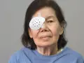 Starsza kobieta z zasłoniętym okiem po operacji zaćmy. Kiedy można iść do dentysty po operacji zaćmy?