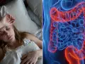Frau im Bett, besorgt. Daneben eine 3D-Darstellung des Darms mit einem leuchtend gelben Tumor. So fing Darmkrebs an.