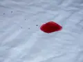Une tache de sang rouge vif sur un tissu blanc. L'eau oxygénée pourrait aider à nettoyer cette tache.