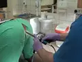 Lekarz w rękawiczkach wykonuje badanie jelit za pomocą endoskopu.