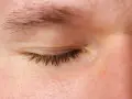Ojo cerrado con pestañas oscuras y piel con leve grasa en los párpados.