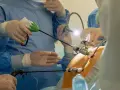 Chirurdzy wykonują histerektomię laparoskopową, używając narzędzi wprowadzonych przez małe nacięcia.