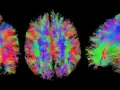 Bunte Faserbahnen des Gehirns, die die komplexen Verbindungen für kognitive Wissenschaft darstellen.