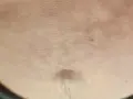 Widoczne brązowe plamy na brzuchu, z widocznym pępkiem i drobnymi włoskami.