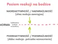 Diagram ilustruje poziom reakcji na bodźce: nadreaktywność (silna reakcja), norma (adekwatna reakcja) i podreaktywność (słaba reakcja, potrzeba wzmocnienia).