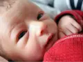 Primo piano del viso di un neonato con crosta lattea. La sua manina è appoggiata su una coperta rossa.