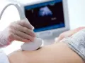 Pierwsze badanie prenatalne w 1 trymestrze ciąży. Lekarz wykonuje USG brzucha przyszłej mamy, na ekranie widać obraz płodu.