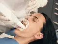 Dentysta używa skanera 3D do diagnozy i leczenia ruszających się zębów.