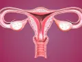 Anatomia kobieca: macica, jajowody i jajniki. Widoczna rozpulchniona szyjka macicy, gotowa na przyjęcie życia.