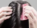 Hände kämmen dunkles Haar, das sichtbare Schuppen zeigt. Die trockene Kopfhaut ist deutlich zu erkennen.