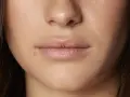 Labios con una pequeña marca, buscando un remedio casero para labios cortados.