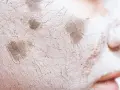 Textura agrietada de una mascarilla de arcilla sobre la piel, mostrando cómo protege la barrera cutánea.