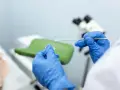 Ręce w niebieskich rękawiczkach przygotowują próbkę do badań cytologia wyniki. W tle mikroskop i fotel ginekologiczny.