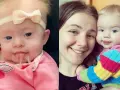 Czy urodzić dziecko z zespołem Downa? Ważne ryzyka i decyzje