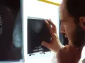 Lekarz analizuje mammografię, szukając oznak raka.