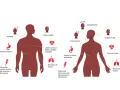 Sintomi infarto da stress: vertigini, sudore freddo, dolore toracico, nausea, intorpidimento, dolore a braccia/collo/mascella/schiena.
