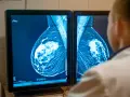 Lekarz analizuje mammografię piersi na ekranie. Wyniki badań, jak te z systemu armidex, są kluczowe dla wczesnego wykrywania.