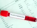 Czerwona probówka z krwią na tle wyników morfologii krwi z oznaczeniem "Żelazo w morfologii".