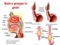 Illustrazione anatomica della gola e dell'esofago, che mostra come un bolo possa causare la sensazione di sentire qualcosa in gola.