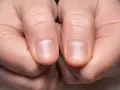 Des ongles fragiles ? Découvrez comment durcir les ongles recette de grand-mère pour des mains sublimes.