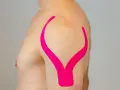 Schulter tapen: Ein Mann mit pinkem Kinesio-Tape auf der Schulter, das wie ein V geformt ist, zur Unterstützung.