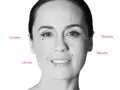 Visage marqué par des rides et cernes. Des points indiquent les zones d'application pour un avis sur l'acide hyaluronique.