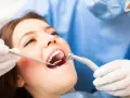 Antybiotyk na ząb z ropą: Co musisz wiedzieć przed wizytą u dentysty?