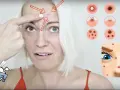 Jak pozbyć się pryszcza w kilka godzin? Szybkie sposoby i triki