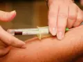 Pobieranie krwi do analizy. Igła wkłuta w żyłę, krew wpływa do probówki. Badanie INR.