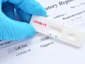 Rękawiczka w niebieskiej rękawiczce trzyma test na COVID-19 z negatywnym wynikiem. Zastanawiasz się, ile kosztuje test na covid?
