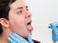 Die alarmierenden Symptome von Diphtherie, die Sie kennen sollten