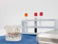 Model szczęki z implantami, probówki i sterylne pudełko. Precyzyjny konturing zębów w gabinecie stomatologicznym.