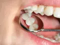 Znieczulenie u dentysty: czy jest bezpieczne? Fakty i mity