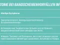 Tabelle zeigt Symptome bei Bandscheibenvorfällen im Hals: Nackenschmerzen, Schulterbeschwerden, Taubheit im Arm, Kribbeln in der Hand.