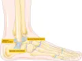 Illustration av fotens ledband: ligamentum fibulotalare posterior, ligamentum calcaneofibulare och ligamentum fibulotalare anterior.