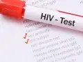 Probówka z krwią do testu na HIV. Zaznaczone HIV antibody i HIV antigen.